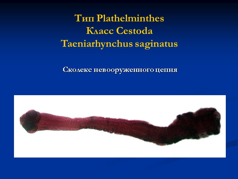 Тип Plathelminthes Класс Cestoda Taeniarhynchus saginatus   Сколекс невооруженного цепня